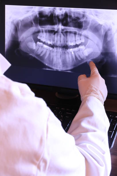 Best Emergency Dental Care for Broken or Chipped Teeth in The Homesteads, TX