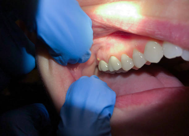Best After-Hours Dental Trauma Care in The Homesteads, TX